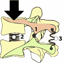 Unidad funcionnal de la columna vertebral | Primspine