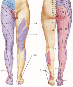 Gráfico de dolor según su localización | Primspine